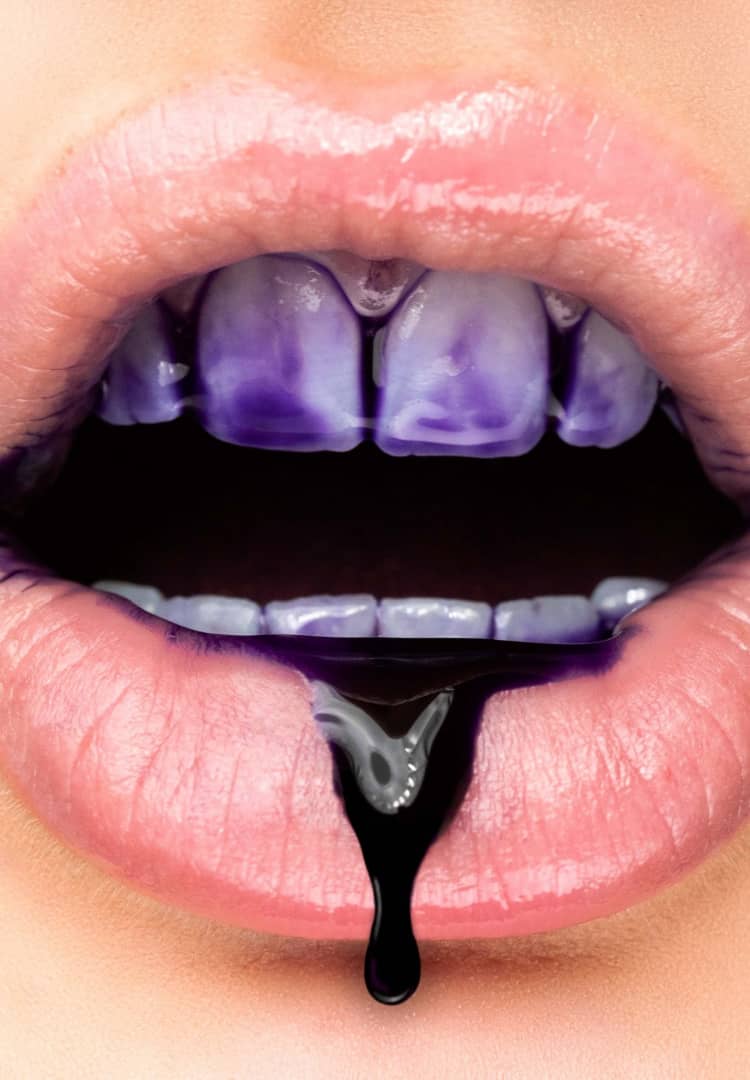 Sérum de Blanchiment Dentaire SMILE™