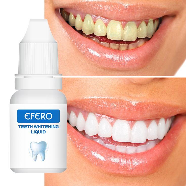 EFORO – Votre Secret pour un Sourire Éblouissant ! 😁✨