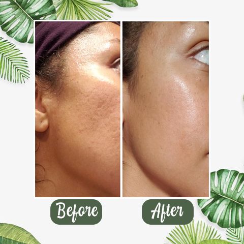 Masque au thé vert pour Hommes et Femmes
