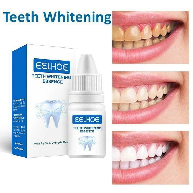 EFORO – Votre Secret pour un Sourire Éblouissant ! 😁✨