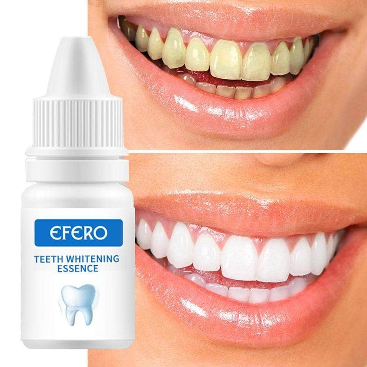 EFORO – Votre Secret pour un Sourire Éblouissant ! 😁✨