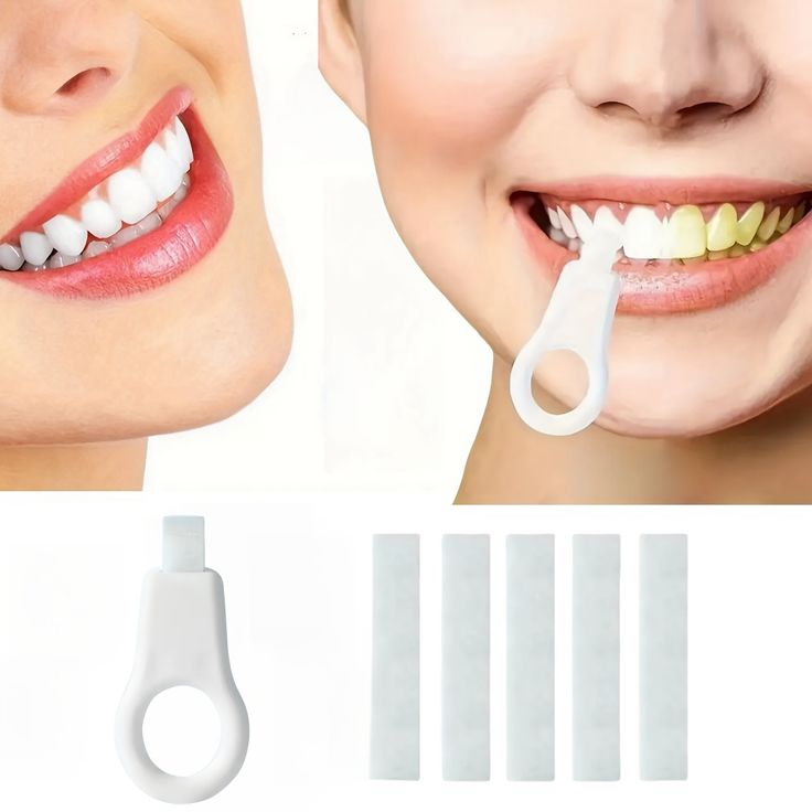 🦷 Stick de nettoyage dentaire nano-physique – La Révolution du Nettoyage Dentaire !